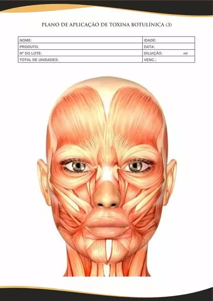 PLANO-DE-APLICACAO-TOXINA-BOTULINICA2.webp