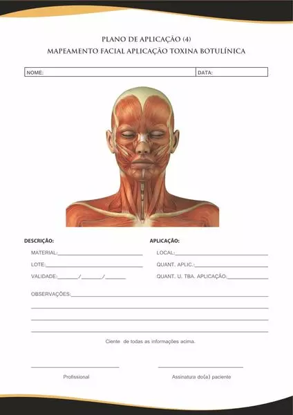 PLANO-DE-APLICACAO-TOXINA-BOTULINICA3.webp